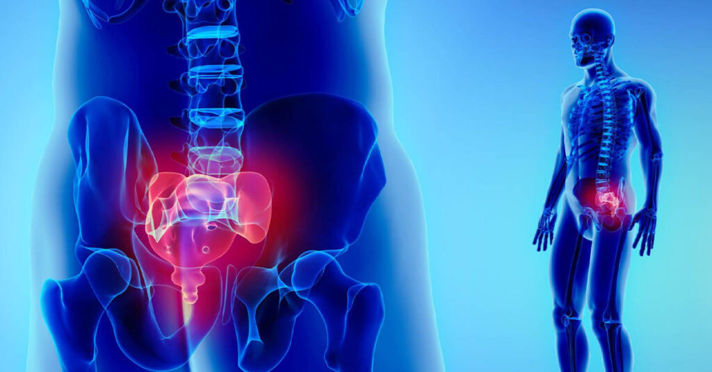 The Dos and Don'ts Can You Safely Exercise with a Bruised Tailbone?